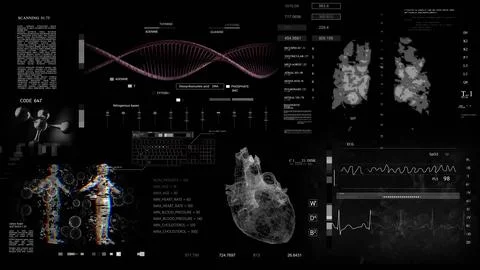 A computer screen displaying an image of a human body and heart on it Stock Photos