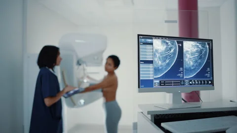 Mammogram Scan Stock Footage ~ Royalty Free Stock Videos | Pond5