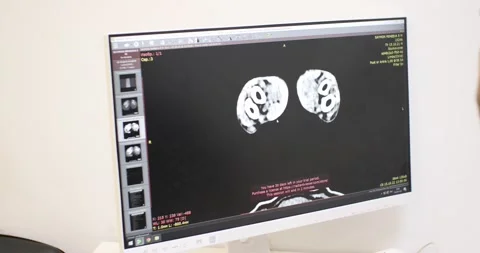 On the computer screen, the veterinarian looks at the results of the magnetic Stock Footage 226836853