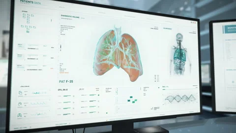 Computer Screen With Working Medical Program Analyzing Lungs Displayed On It Stock Footage 253888865