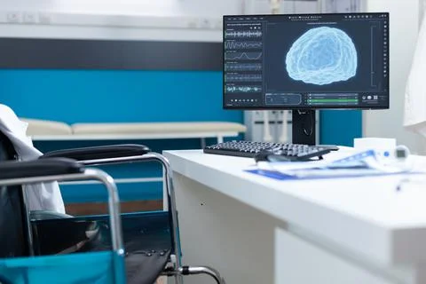Computer standing on table having brain ct-scan on screen Foto stock
