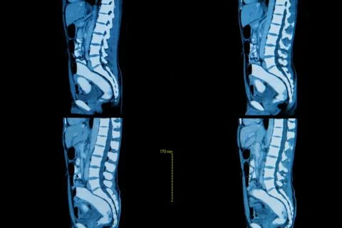 Computer tomography of  human body Stock Photos