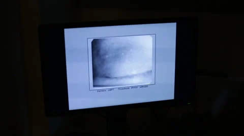 A computer tracking someone's eye movement Stock Footage 58628030