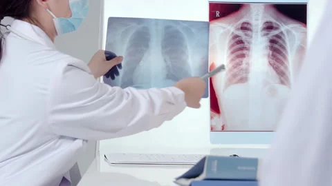 Concentrated doctor physician checking x-ray image of patient's lungs during Stock Footage 329005227