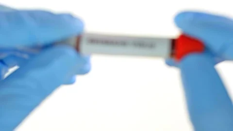 Concept blood test. Hands in blue gloves, hold the tube with real blood. Видео 106490940