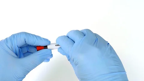 Concept blood test. Hands in blue gloves, hold the tube with real blood. 스톡 동영상 106519648