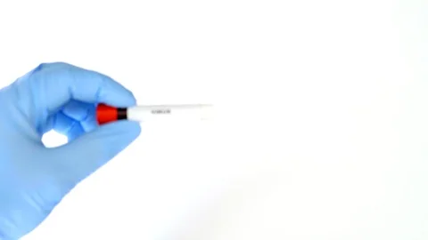Concept blood test. Hands in blue gloves, hold the tube with real blood. 库存影片 106544402