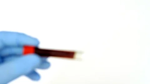 Concept blood test. Hands in blue gloves, hold the tube with real blood. Stock-Footage 106545147