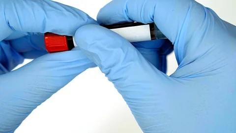Concept blood test. Hands in blue gloves, hold the tube with real blood. Stock-Footage 106545288
