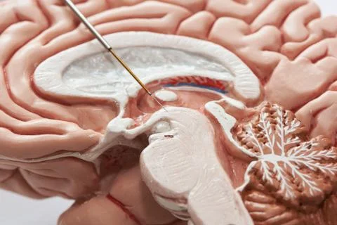 Concept of brain recording in subthalamic nucleus for Parkinson disease surge Stock Photos