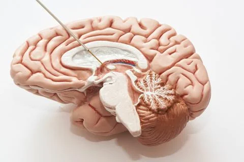 Concept of brain recording in subthalamic nucleus for Parkinson disease surge Stock Photos