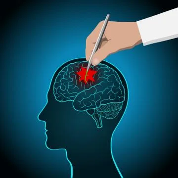The concept of brain recovery, memory, stroke, treatment of brain diseases Illustrazione stock