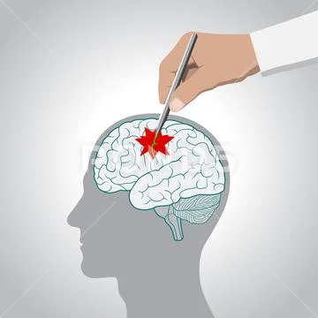 The concept of brain recovery, memory, stroke, treatment of brain diseases Stock Illustration