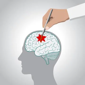The concept of brain recovery, memory, stroke, treatment of brain diseases Illustrazione stock