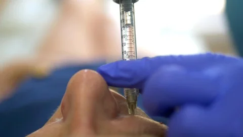 The concept of contour plastic face. A plastic surgeon's hand puts a filler Stock Footage 112071573