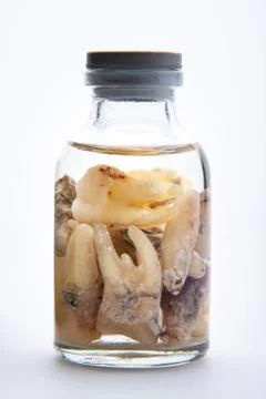 Concept - dentist's trophy. Set of removed teeth in a glass medical vial with Foto stock