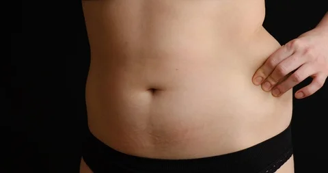 The concept of getting rid of excess weight. Girl cuts off fat deposits with Stock Footage 126115453