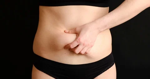 The concept of getting rid of excess weight. Girl cuts off fat deposits with Stock Footage 126364201