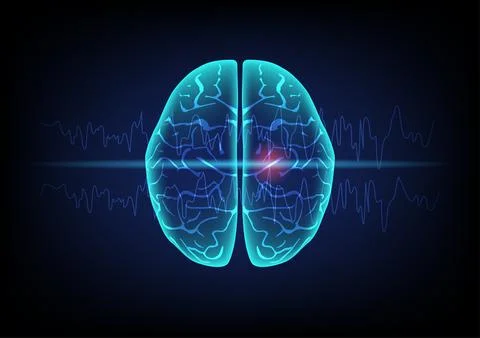 Concept of human brain and epileptic seizure. Stock Illustration
