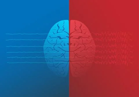 Concept of normal brain and epileptic brain. 스톡 일러스트