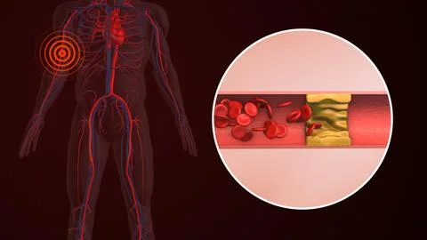Concept of peripheral pain in human hand Stock Illustration