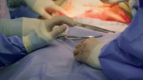 Concept of plastic surgery, implants, cosmetic surgery. Stock Footage 270470312