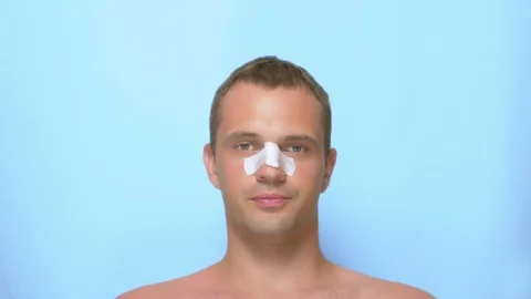 Concept of plastic surgery, a man after a plastic surgery on the face Video stock 112094820