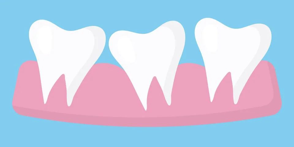 The concept of uneven teeth. Stock Illustration