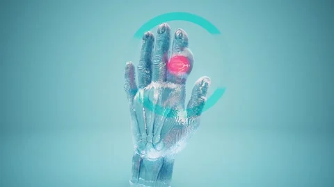 Conceptual 3D Animation of Gout in Finger Joint and Inflammation Stock Footage 317532955
