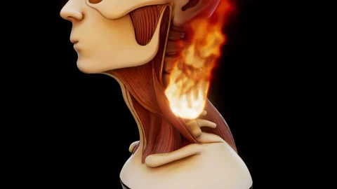 Conceptual 3D animation of a neck strain... | Stock Video | Pond5