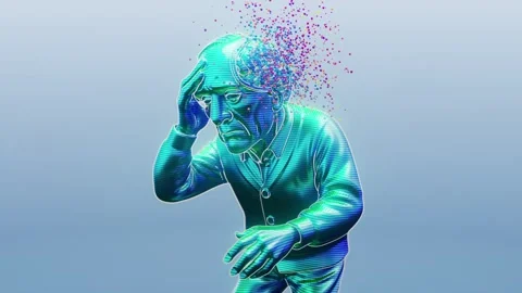 Conceptual 3D animation of an old man with brain aging Stock Footage 321679531