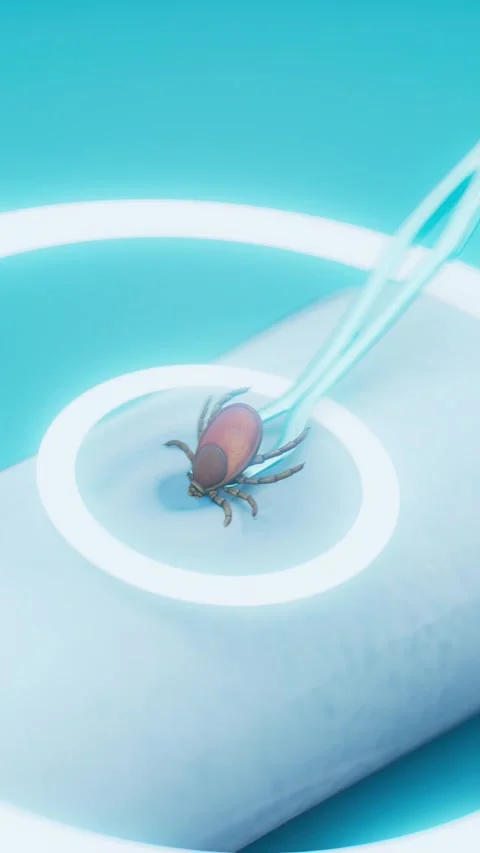 Conceptual 3D animation of tick removal from human skin Stock Footage 337393535