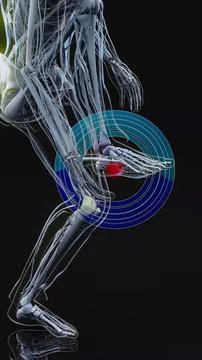 Conceptual 3D illustration of an x-ray man with plantar foot pain Stock Illustration