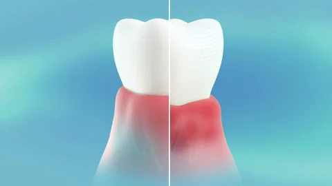 Conceptual presentation of a healthy, cured tooth in the gum.  Stock Footage 142000530