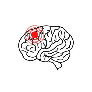 Concussion brain or head ache thin line icon Stock Illustration