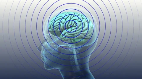 Concussion Effect On Human Brain Activity Stock Footage 324392321