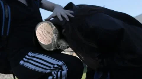 Concussion slow motion and animated overlay Stock Footage 46511819
