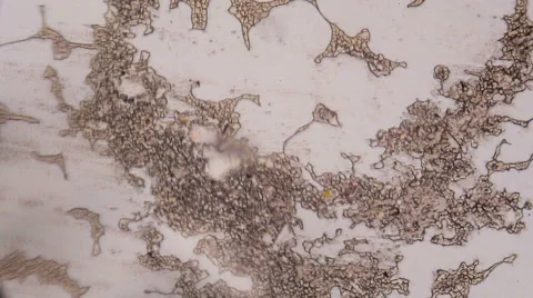 Congealed blood cells under the microscope Stock Footage 62440787