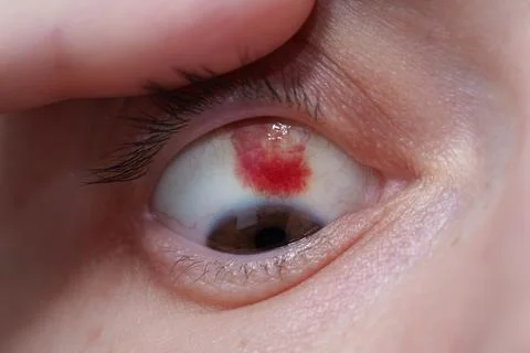 Conjunctiva. 库存照片