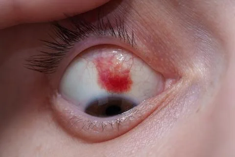 Conjunctiva. 库存照片