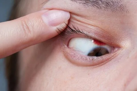 Conjunctiva. 库存照片