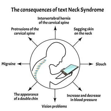 Consequences of Text Neck Syndrome. Spinal curvature, kyphosis, lordosis of the Stock Illustration