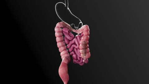 Constipation  4K Video stock 285108899