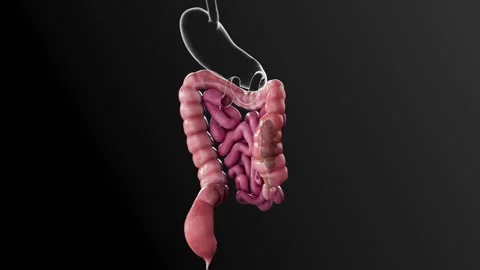 Constipation  HD Video stock 285108992