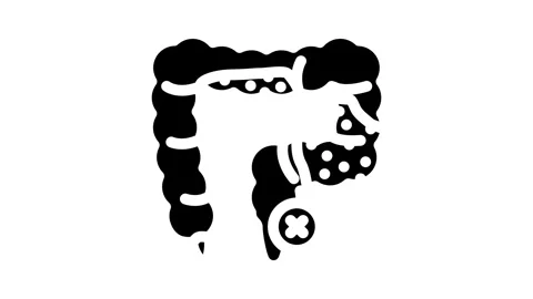 Constipation treatment glyph icon animation Stock Footage 326731398