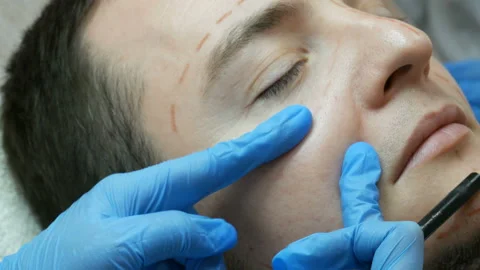 Consultation of man in plastic clinic Stock Footage 88057205