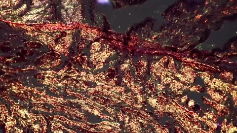 Contrast microscopic slide with cervix tissue sample magnified in 100 times Stock Footage 249017301