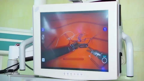 Control center of a surgical robot. In the robotic surgery operating room. Stock Footage 307491240