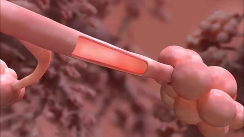 COPD and chronic bronchitis Stock Footage 264660581