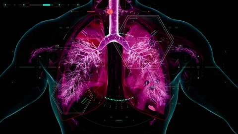 Copd lung disease, chronic obstructive pulmonary disorder concept Stock Footage 292993908